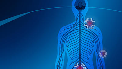 Fibromyalgia Image 510X340px